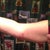 1 week front of arm