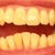 7-4-2012 Tray 9/24