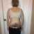 Day 6 post-op