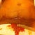 The sutures was cut and removed and the wounds look all like this. After 6 weeks it still leaks mucus and blood
