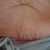 wrinkly stomach