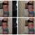 2 Week Post Side