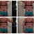 2 Week Post Back