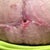 My hole :(