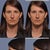 Before pics in the left column, and computer imaging in the right column. I also had a chin implant imaged in the right column, but I decided against it.
