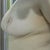 10 month right ride with 4 month revision scar