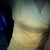 This was today 15 days PO at the end of the day after a nice big bowl of pasta lol...not too shabby
