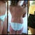 2 days Pre-Op lipo of flank area