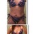 Bikini before & after - 18 days PO