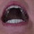 Spacing on front teeth