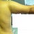 Photo3: 4 weeks after vaser. My arms are still swelling but my mom said "your arms look smaller and  better than first photo
