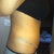 13 days po fluid buld up makn me pudge