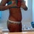 side view swelling after margaritas fries and fried shrimp looks 3 months preggo scar higher on this side than other