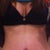 5wks , would be soooo sooo much happier if I didn't have the vertical scar.