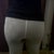 Butt Lift with 600 cc each Cheek - 10 days post Op