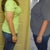 Profile view of me pre and 1 yr 5 mos post lap-band surgery.