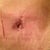 My skin is so thin and dry that the bandaid cut my skin around my bb