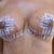 Breasts 2 weeks post Ultimate Breast Lift