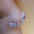 Breasts 2 weeks post Ultimate Breast Lift