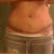 10wks post op