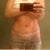 10wks post op