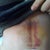 Look how tight he pulled my abs you can see by the bruise line. Feels like I have done a thousand press ups !