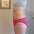 6 days post op