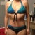 1 month post op