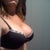 7 weeks Post Op