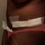 The left side post-op day 2