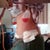 this us my side view the day of surgery. sorry about all the drains.