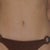 before coolsculpting
