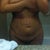Post Op Day 2