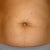 Taken the day before surgery..can't even see my belly bottom.