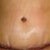 the scar doesn't look pretty