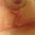 Under right side