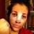 Funny picture I sent my friends. Day of surgery. Told them I got into a fight! :)