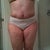 9-29-12 2.5 months