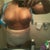Day 4 Post op