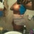 Side: Day 4 Post op