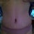 3 weeks po, starting to see ab muscles