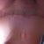 Close up of scar, sorry it is upside down =0(