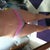 8 weeks post op