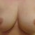 Day 16 post op.Leaning forward slightly.