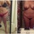 Before and 6months post op