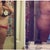 Before and 6 months post op