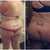 Before and 6 months post op
