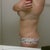 5 weeks 3 days. rt side again you can see the fatty part.