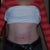 4 weeks post op