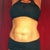 Before Pic Day Of surgery Couple Hours Before
Not a Happy Mommy:( Hated My stomach!